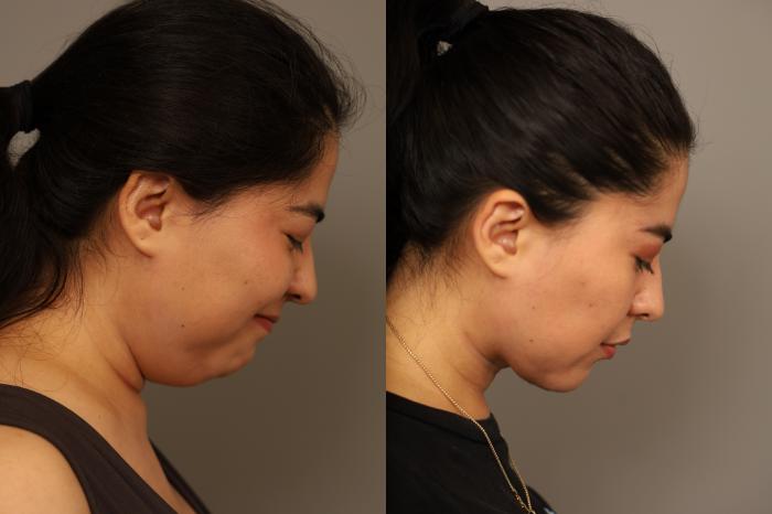 View of chin and neck while looking downward